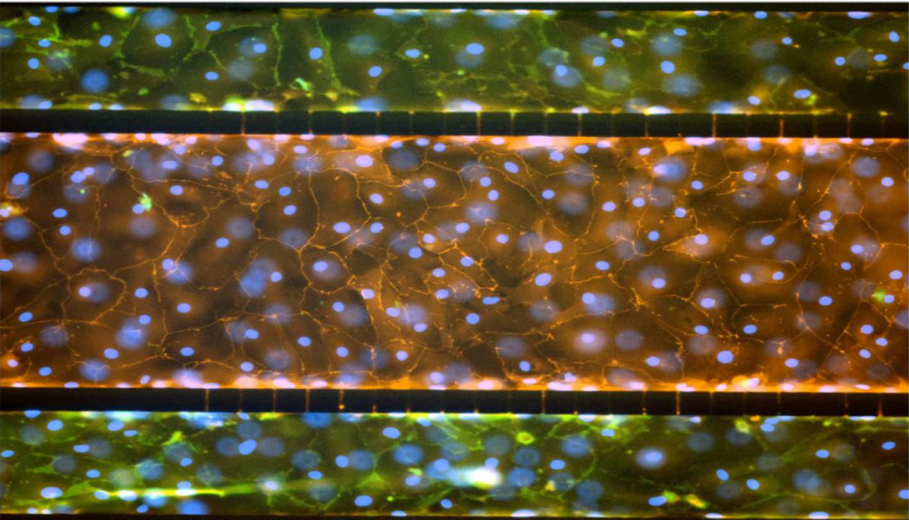 Modèle de poumon alvéolaire