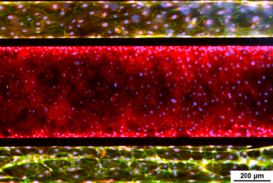 Modèle de poumon des petites voies respiratoires